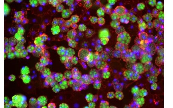 Fluorescence image of adipocytes cultured on a chip