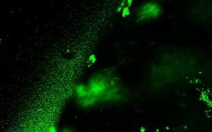 Fluorescence image of bacteria colonizing intestinal cells