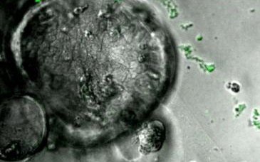 Brightfield image of an organoid with fluorescent bacteria nearby