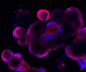 Fluorescence image of colorectal cancer organoids