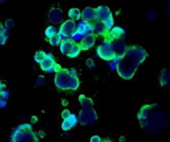 Fluorescence image of organoids