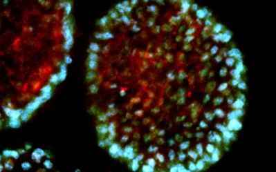 Fluorescence image of multicellular spheroids